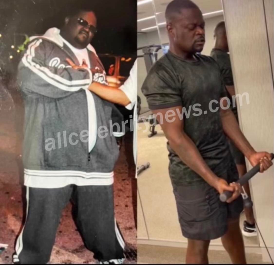 Poo Bear lost an incredible 240 pounds without lap band surgery or other weight loss surgery