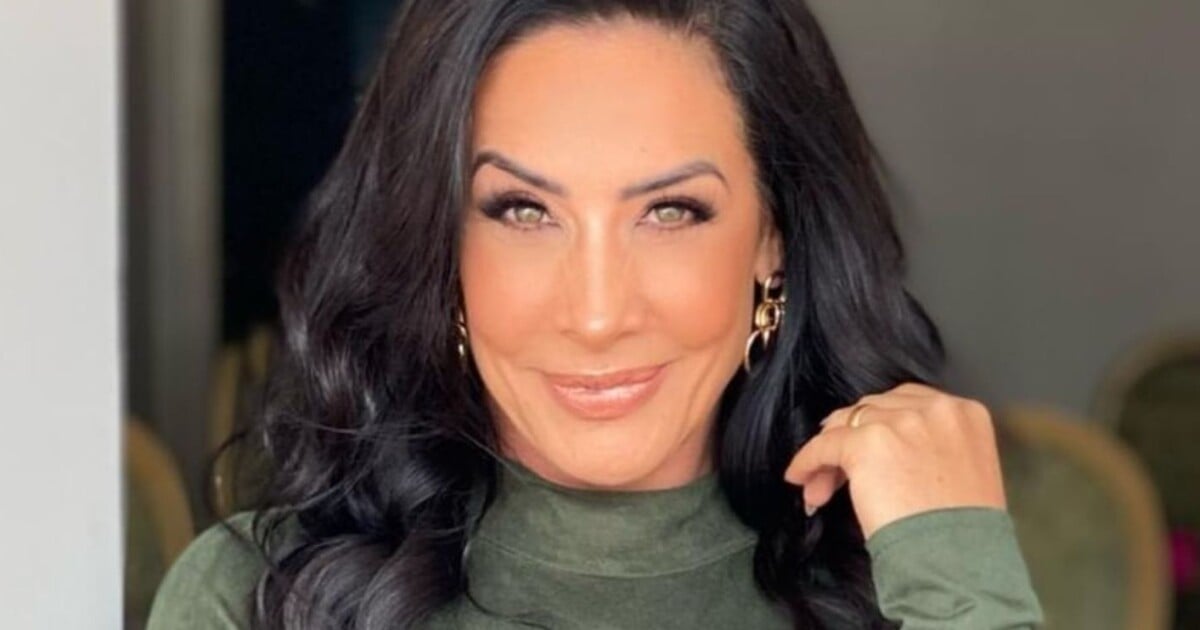Scheila Carvalho remove preenchimento do rosto; por que famosos estão desistindo dos preenchedores? Cirurgiã explica!