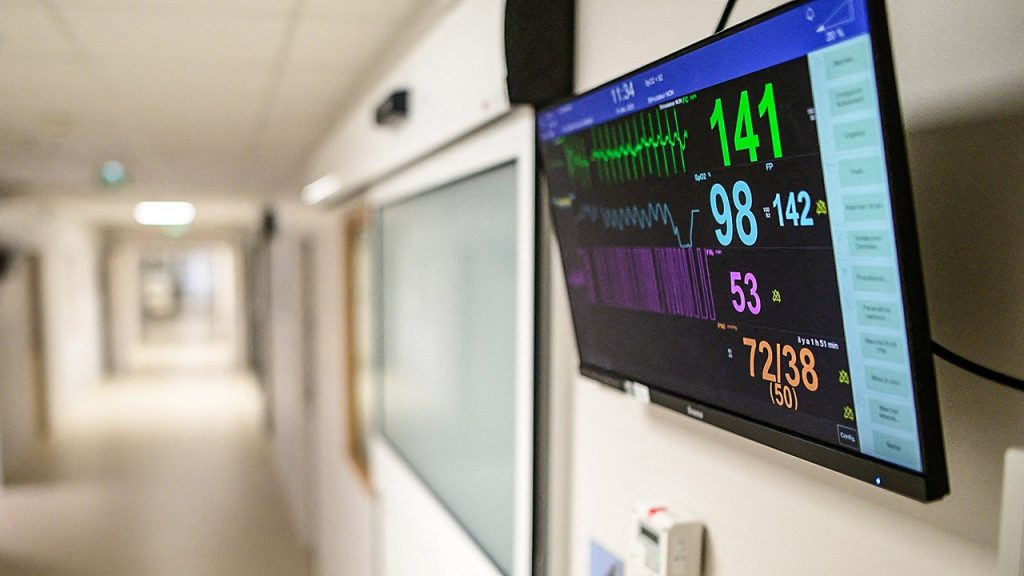 AI detects hidden sudden cardiac death warning in routine ECG, study finds